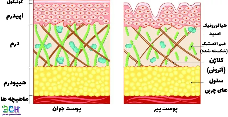 تصویر زیر تفاوت بین پوست جوان در سمت چپ و پوست مسن با کلاژن کمتر در سمت راست را نشان می دهد.